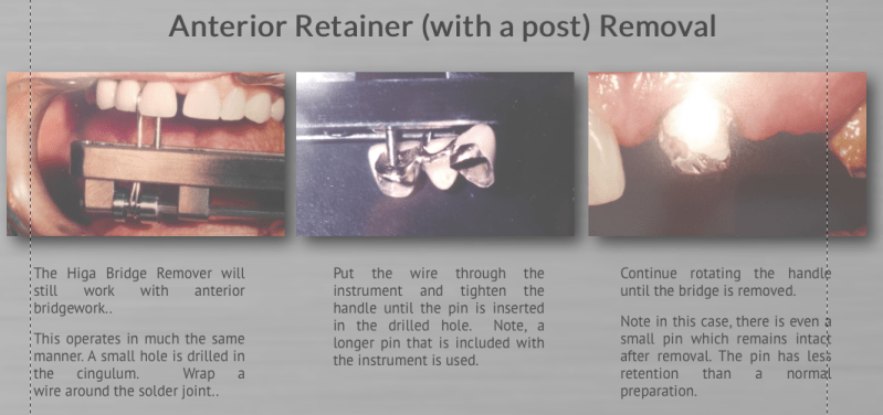 Screen Shot 2017-12-05 at 12.03.18 AM